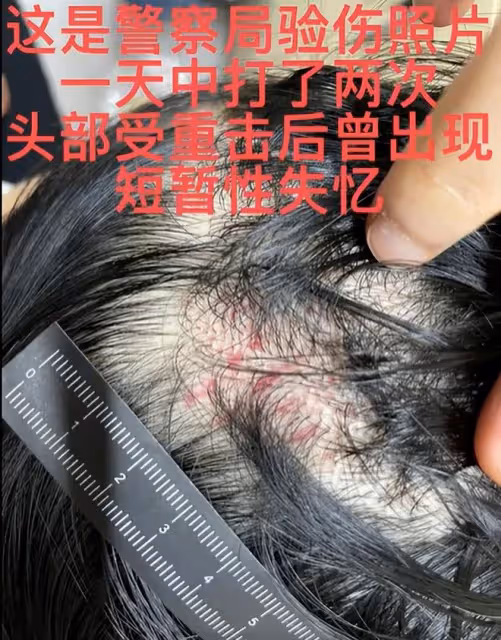 44歲男星家暴視頻曝光!掐妻子脖子用木板毆打,女方被打暈渾身傷