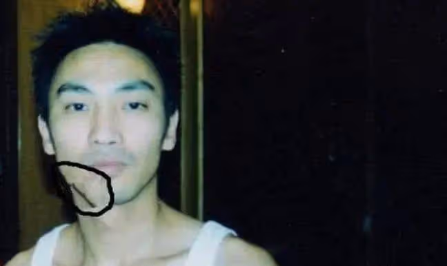 僅憑一首歌紅遍全國,演出時被伴舞連砍三刀毀容,如今身價上億!