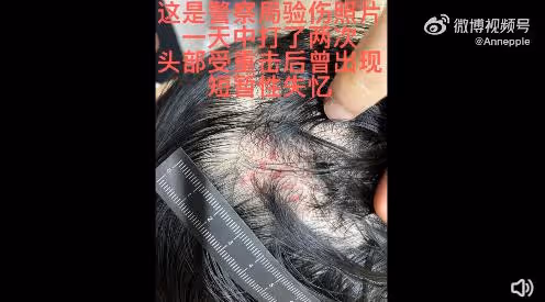 熱搜爆了! 男演員被控家暴,視頻畫面曝光