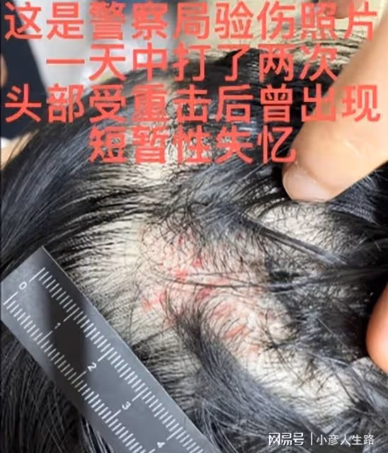 王東家暴懷孕妻子視頻曝光,重擊頭部致昏迷失憶,曾婚後失聯3次