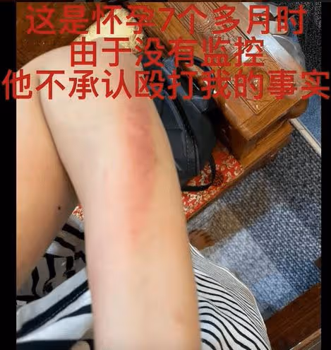嚴重家暴妻子視頻曝光 王東回應：終於解脫了