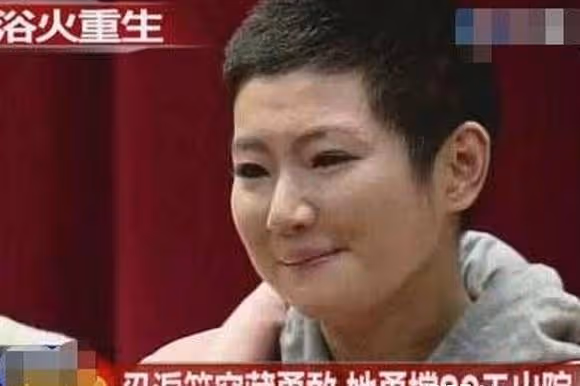 他為何娶了毀容的Selina後，又狠心離婚？婚禮的一幕「耐人尋味」