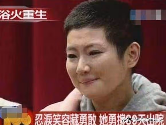 他為何娶了毀容的Selina後，又狠心離婚？婚禮的一幕「耐人尋味」