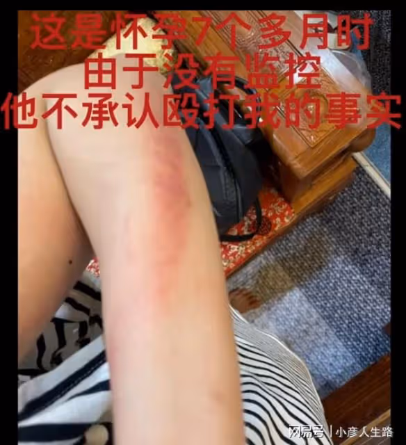 王東家暴出軌事業涼涼,自曝是王東出軌對象的女網友現改口否認