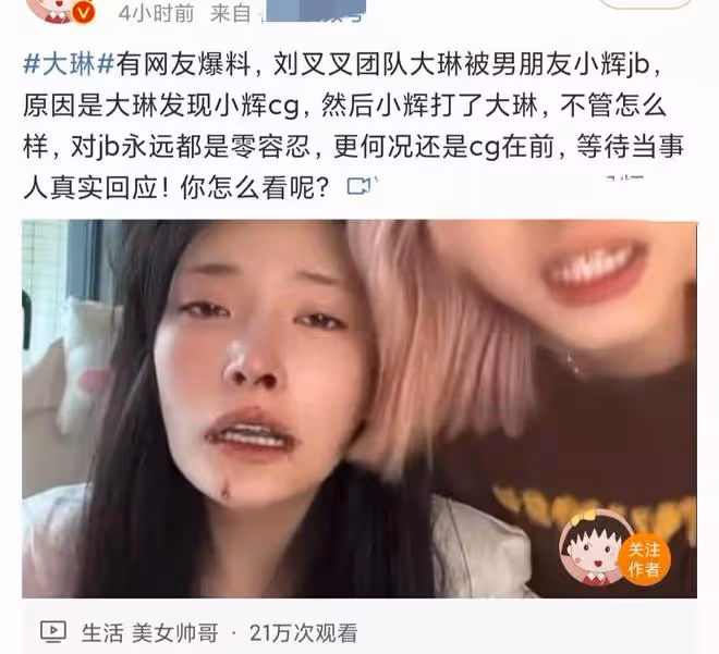 美女網紅被男友暴打!滿臉是血邊直播邊報警,男方被扒有家暴前科