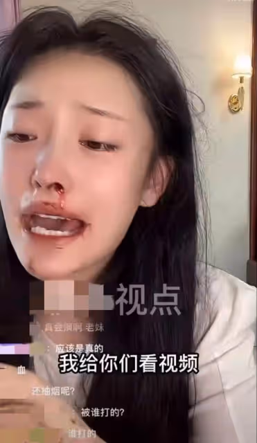 美女網紅被男友暴打!滿臉是血邊直播邊報警,男方被扒有家暴前科