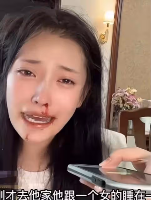 美女網紅被男友暴打!滿臉是血邊直播邊報警,男方被扒有家暴前科