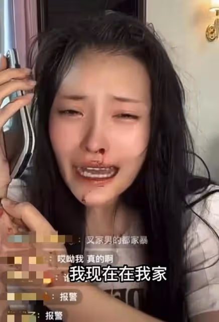 美女網紅被男友暴打!滿臉是血邊直播邊報警,男方被扒有家暴前科