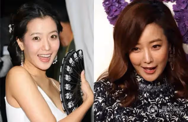 韓國四位整容美女,曾經的人氣女王現在變得認不出了