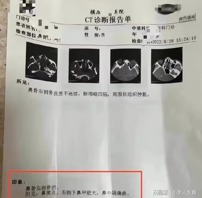 成毅《蓮花樓》未播先糊?代拍被打鼻骨折,劇組道歉被指避重就輕