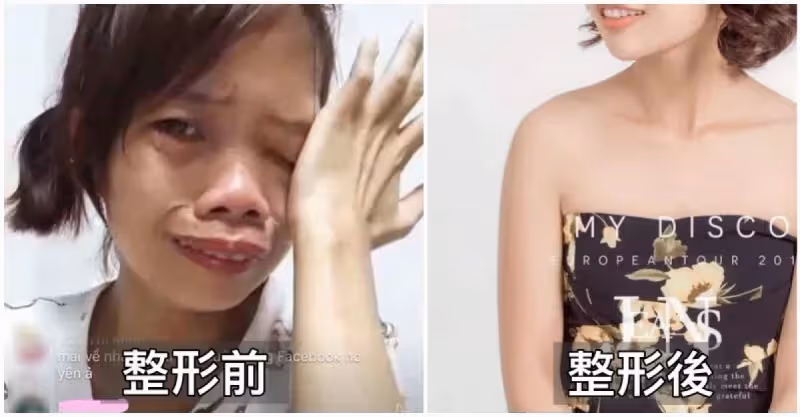單親媽直播賺錢被笑「妳長得好像河童」節目出錢讓她整形「變身韓系電眼女神」正到逆齡20歲