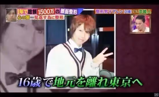 最強軟飯男!花一億整容,拔光16顆牙齒只為取樂富婆?
