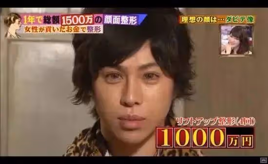 最強軟飯男!花一億整容,拔光16顆牙齒只為取樂富婆?