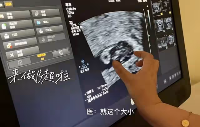 30歲女星官宣結婚懷孕!挺皮球肚產檢,與馮小剛傳緋聞老公成謎