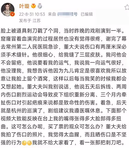 葉璇演出突發意外!臉被道具刀戳窟窿洞,緊急送醫縫針太血腥