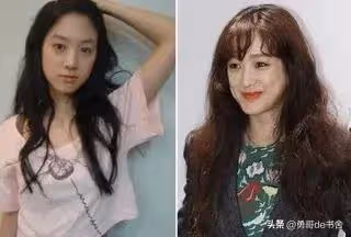 41歲過氣女星未婚未孕，因整容聲名狼藉，如今一個人獨居火遍全網