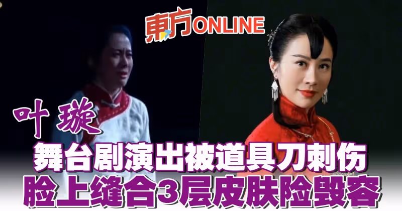 葉璇舞台劇演出被道具刀刺傷　臉上縫合3層皮膚險毀容