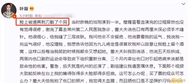 42歲葉璇演戲受傷，臉被刺刀戳出血窟窿，醫生縫3層皮膚恐留疤