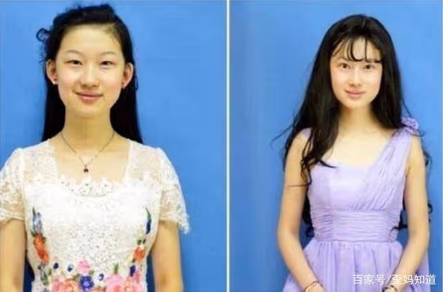 19歲女孩苦戀劉亦菲,名字「改一樣」,花百萬整容4年卻成這模樣