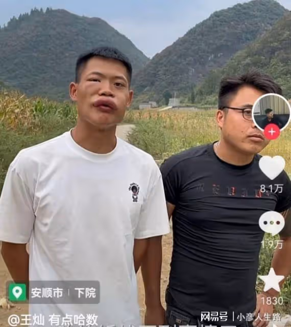 博取流量沒底線?男網紅生吃蜜蜂秒變香腸嘴,網友:建議封殺