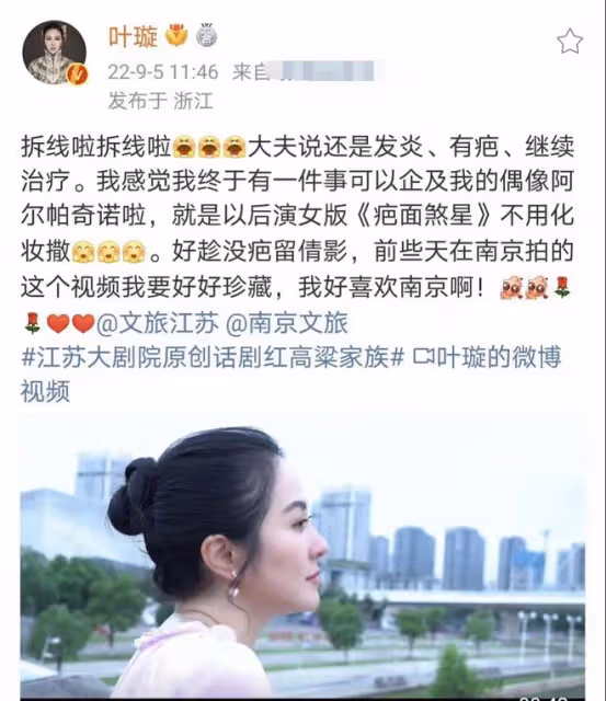 葉璇臉受傷後再發聲,曝最新手術進展,已拆線或有留疤風險