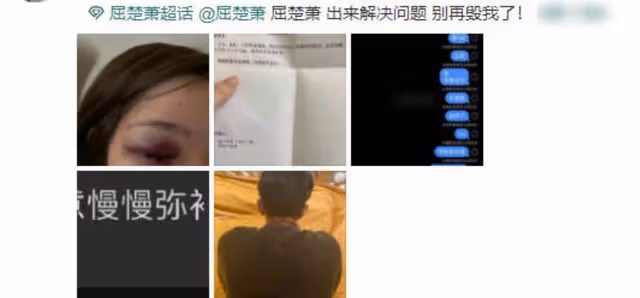 27歲當紅男星曝戀情!與小3歲清純女星同住酒店3天,曾陷家暴風波