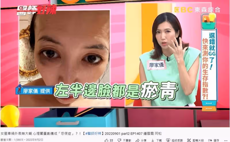 遭追撞車尾全毀!本土劇女星「爬出車外求救」 外表無大礙「1個月後發現嚴重後遺症」淚崩:我很害怕