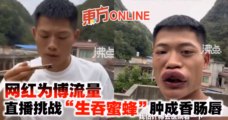 網紅為博流量　直播挑戰「生吞蜜蜂」腫成香腸唇