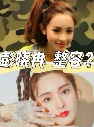 出道多年長相瘋狂變化,從醜小鴨變成白天鵝,她才是整容如換臉!