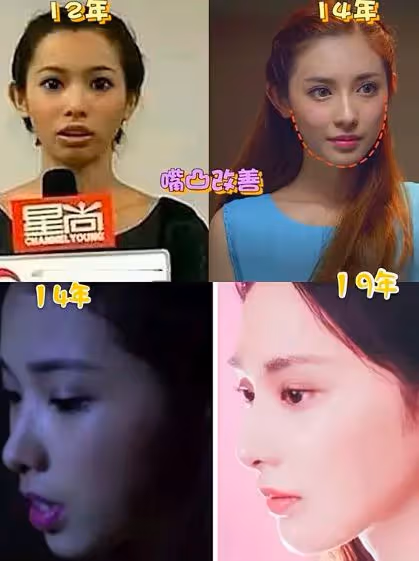 出道多年長相瘋狂變化,從醜小鴨變成白天鵝,她才是整容如換臉!