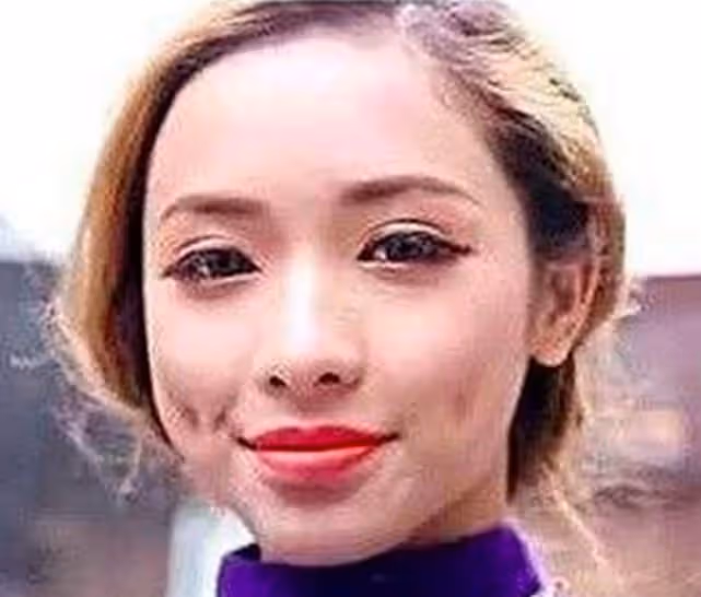 出道多年長相瘋狂變化，從醜小鴨變成白天鵝，她才是整容如換臉！