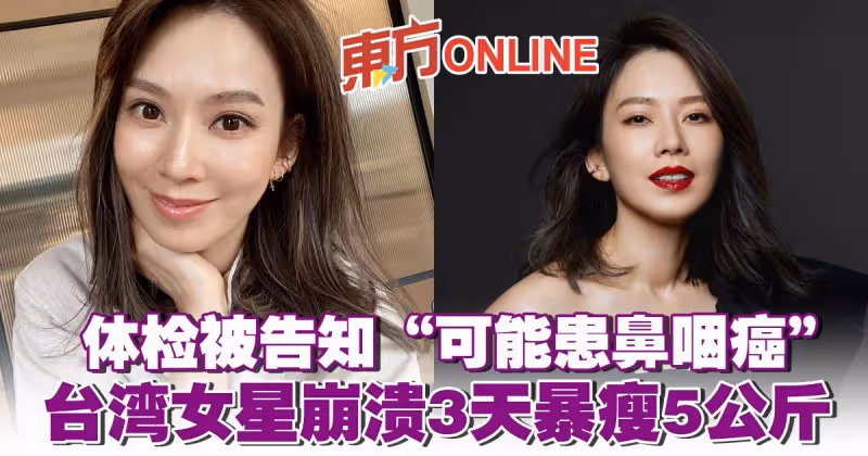 體檢被告知「可能患鼻咽癌」　台灣女星崩潰3天暴瘦5公斤
