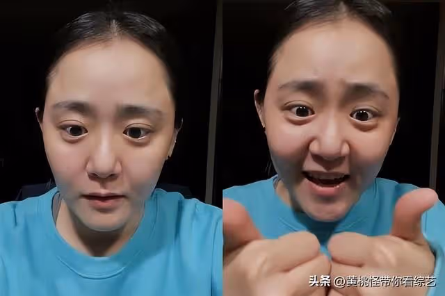文根英：險些截肢手臂長疤明顯，發福垮臉顯老，退居幕後享受生活