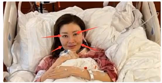 瘦成皮包骨頭、青筋凸出,9位脫相式衰老的女星,今昔對比差距大