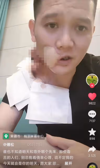 36歲歌手傅鬆口腔癌去世!生前嚼檳榔6年,最後一次露面臉部潰爛