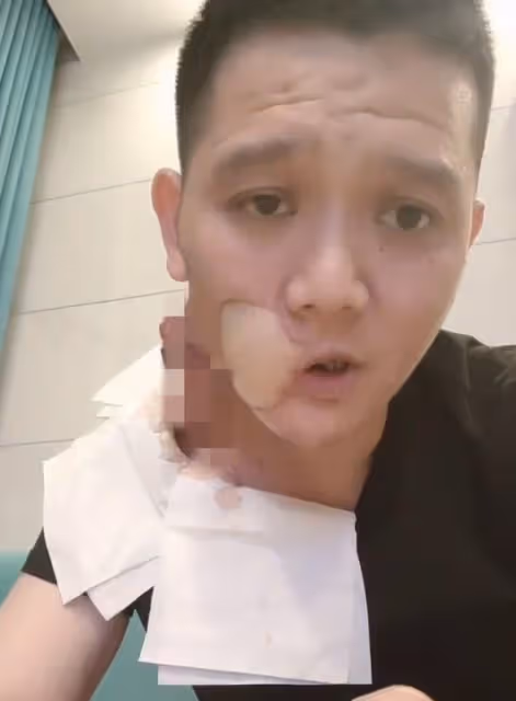 36歲歌手傅鬆口腔癌去世!生前嚼檳榔6年,最後一次露面臉部潰爛