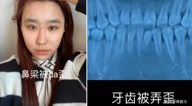 歌手賽文被曝家暴出軌 致其墮胎2次畫面曝光