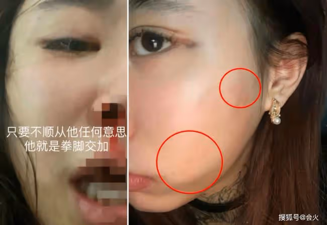 歌手賽文被曝家暴出軌 致其墮胎2次畫面曝光