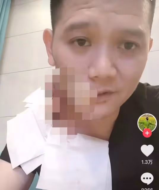 歌手傅松患口腔癌去世,最後一面臉部潰爛,主動放棄治療享年36歲