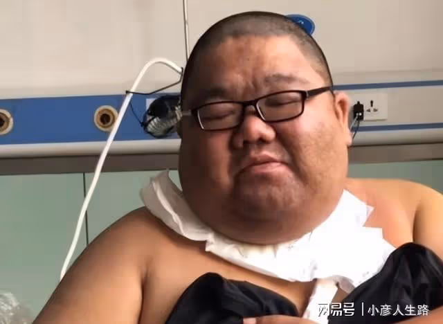 吃播四巨頭:兩年去世倆,胖猴仔瘦200斤後重操舊業,恩克臉發黑