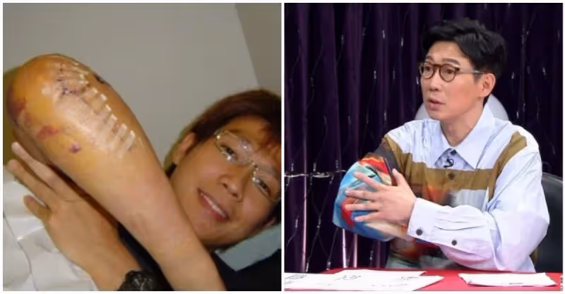 中秋出意外！情歌王子「趕拍戲從2樓墜落」暈10多秒　揭傷勢「右手粉碎性骨折」：50歲一堆舊傷