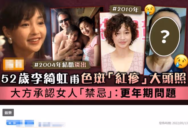 李綺紅承認已到更年期！素顏出鏡臉上布滿雀斑紅疹，52歲定居國外