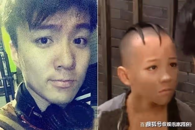 他憑「三毛」一夜爆紅,因謝頂縫合300多針,33歲容貌大變無人識