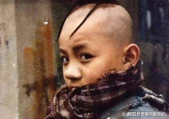 他憑「三毛」一夜爆紅,因謝頂縫合300多針,33歲容貌大變無人識