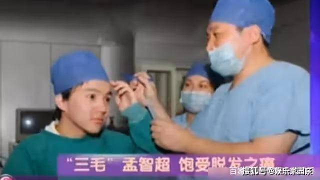 他憑「三毛」一夜爆紅,因謝頂縫合300多針,33歲容貌大變無人識