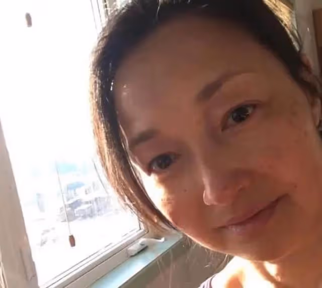 52歲TVB前花旦曬素顏照!皮膚狀態極差,滿臉雀斑紅疹,頸紋明顯