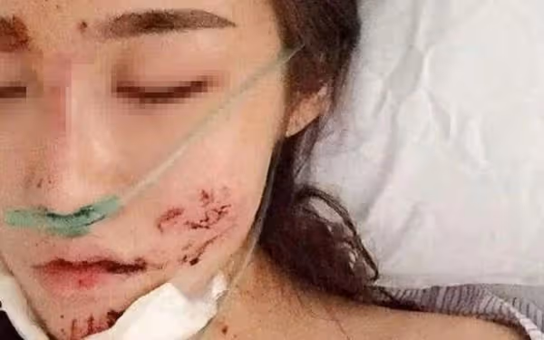 自從車禍毀容後,公婆嫌棄我醜八怪讓我滾,老公一氣拿出了房產證,公婆不敢再吭聲...