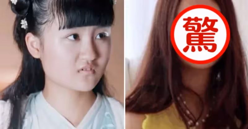 有種「逆襲」叫《花千骨》幽若，因長殘被嘲後出國，如今卻美到認不出