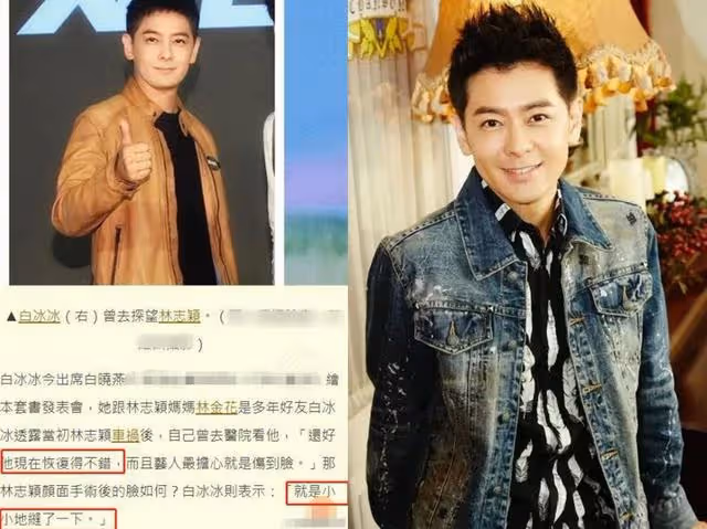 林志穎的臉無大礙?面部修復手術細節曝光,友人稱其很快就能露面