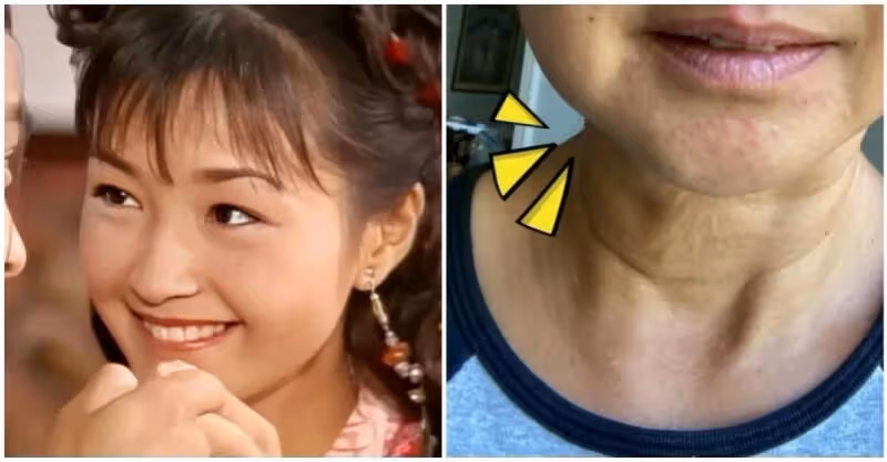 被批評老了！最美郭襄突曬「52歲素顏自拍照」紅疹顯眼　大方認了「更年期帶來的」：學會優雅老去